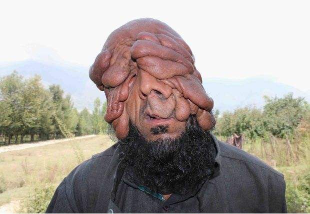 世界上最惡心的人 盤點世界上最丑最惡心的人都有哪些4